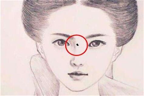 刀厄痣 意思
